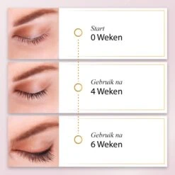 UGenics Wimperserum - Wimper Groei - Lash Serum - Eyelash & Wenkbrauw Serum - 5 Ml -Cosmetica Winkel 1200x1200 270
