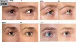 L'Oréal Paris Clinically Proven Wimperserum - 2 Ml 24 L'Oréal Paris Clinically Proven Wimperserum - 2 Ml -Cosmetica Winkel 1200x670