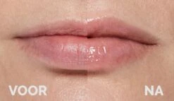 Instant Effects - 3D Lip Plumper Lipgloss Lip Filler - 20% Vollere Lippen In Slechts 2 Minuten! 9 Instant Effects - 3D Lip Plumper Lipgloss Lip Filler - 20% Vollere Lippen In Slechts 2 Minuten! -Cosmetica Winkel 1200x696