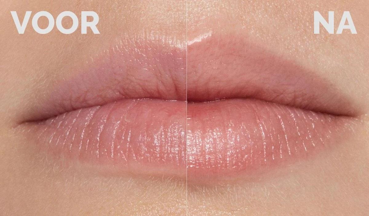 Instant Effects - 3D Lip Plumper Lipgloss Lip Filler - 20% Vollere Lippen In Slechts 2 Minuten! 4 Instant Effects - 3D Lip Plumper Lipgloss Lip Filler - 20% Vollere Lippen In Slechts 2 Minuten! - Afbeelding 2