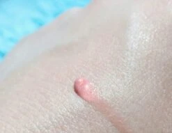 Biodermal Sun Lipbalm SPF25 - Tube 12 Ml - Natural Pink - Lippenbalsem 9 Biodermal Sun Lipbalm SPF25 - Tube 12 Ml - Natural Pink - Lippenbalsem -Cosmetica Winkel 1200x927